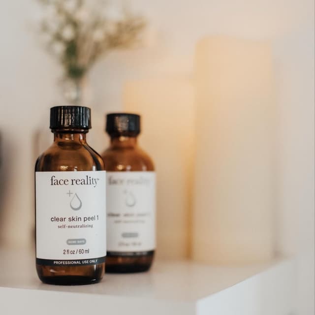 Acne Bootcamp Package of 10 at Skin & Soul Aesthetics in Turlock, CA